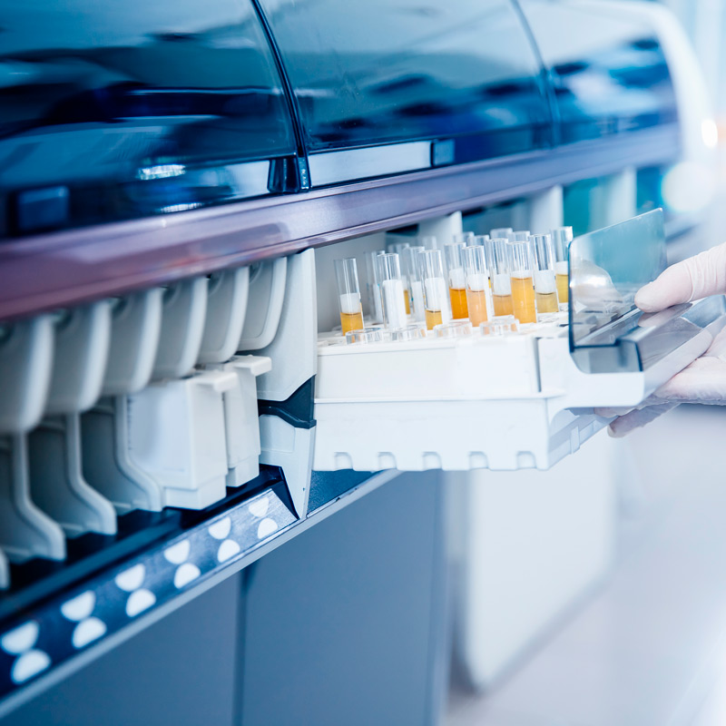 What does ChatGPT think about the automation of industrial QC microbiology laboratories?